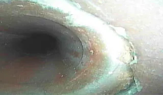 Detecção de infiltrações e ruturas internas em canalizações - Fermorel Rutura em canalização e sinais de infiltração identificados pela Fermorel durante diagnóstico técnico em Lisboa